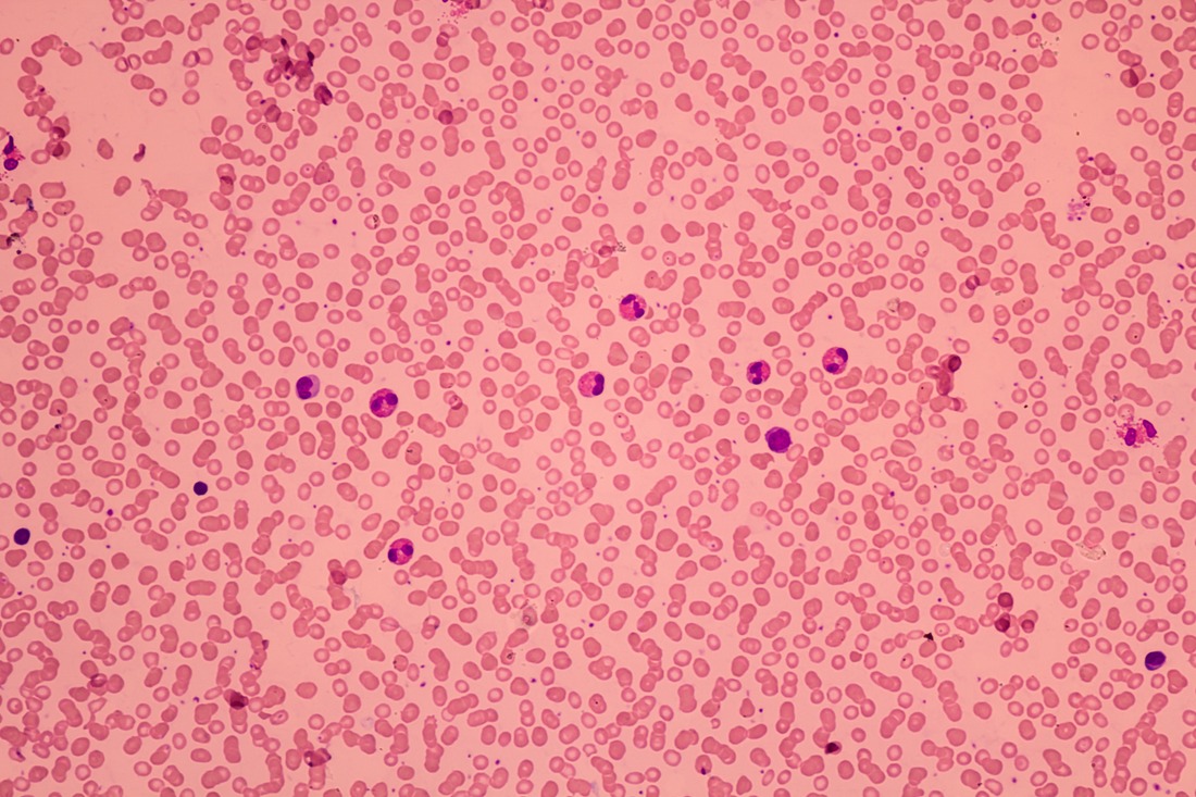 Blood cells, Hematology