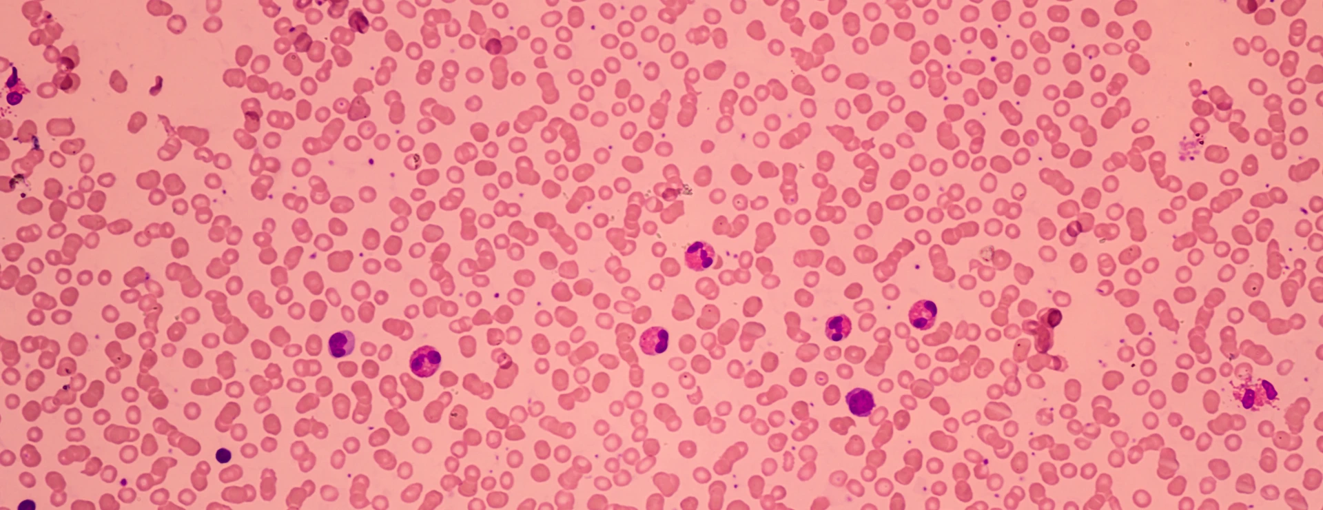 Blood cells, Hematology