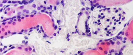 PPZ20_Kidney__940x250
