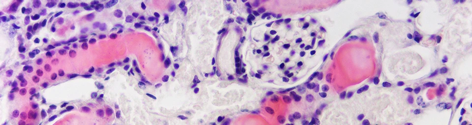 PPZ20_Kidney__940x250