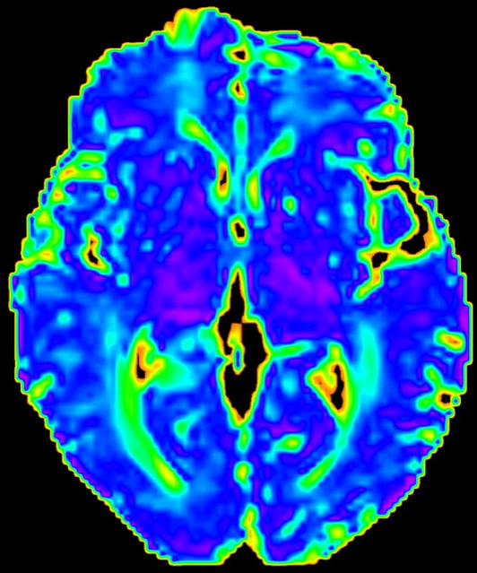 HMGU Image_Peeken