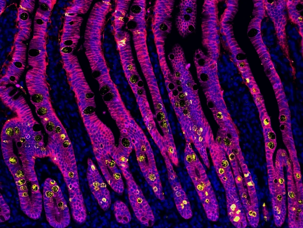 Rodriguez-Calvo_Duodenum