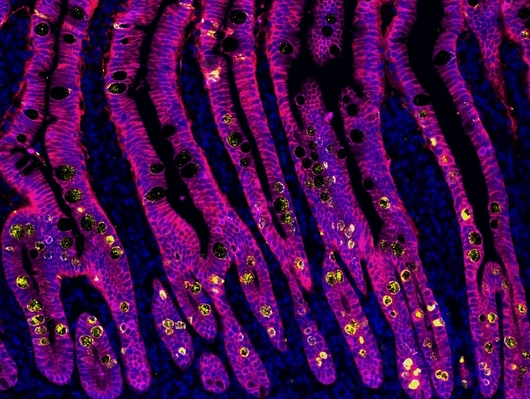 Rodriguez-Calvo_Duodenum