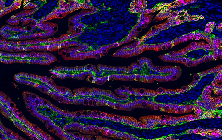 Rodriguez-Calvo_Epithelium_duodenum