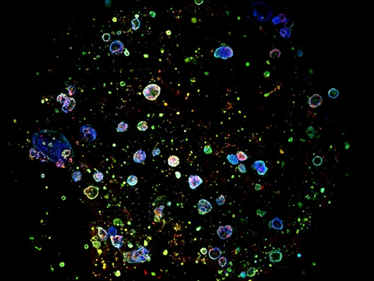 burgstaller_Lung Organoids_V1_630x473px