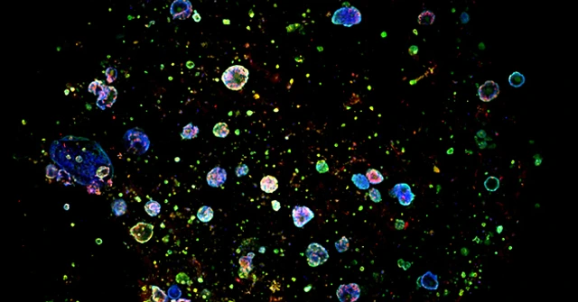 burgstaller_Lung Organoids_V1_630x473px