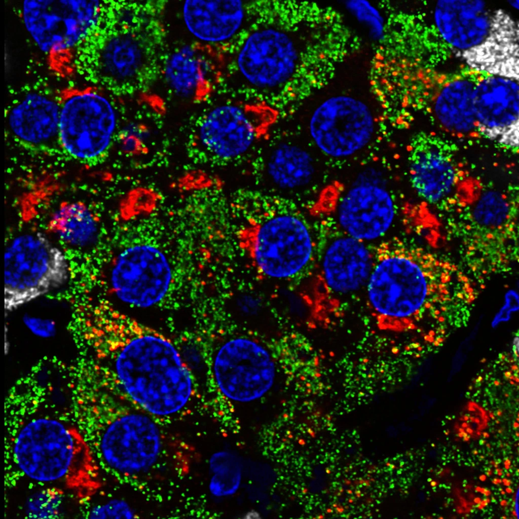 Rodriguez-Calvo_islet