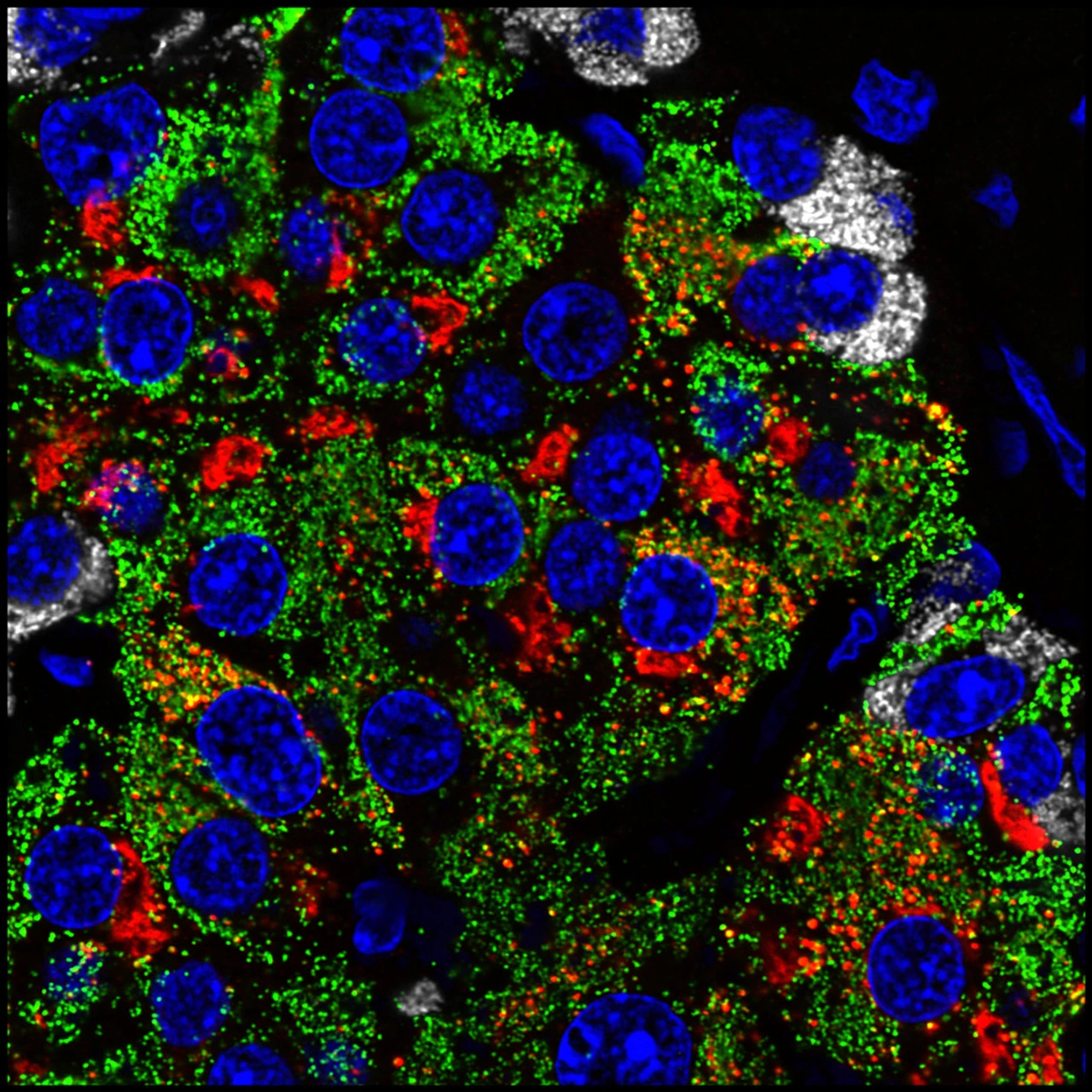 Rodriguez-Calvo_islet
