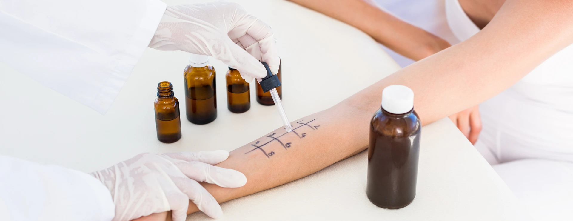 Pricktest zur Diagnose einer Allergie