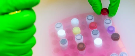 Samples on dry ice