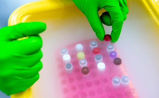 Samples on dry ice