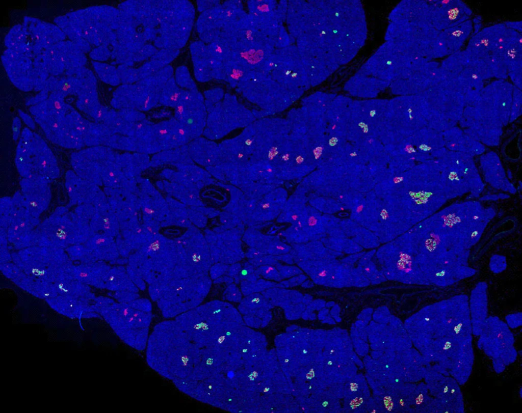 Rodriguez-Calvo_pancreas_whole