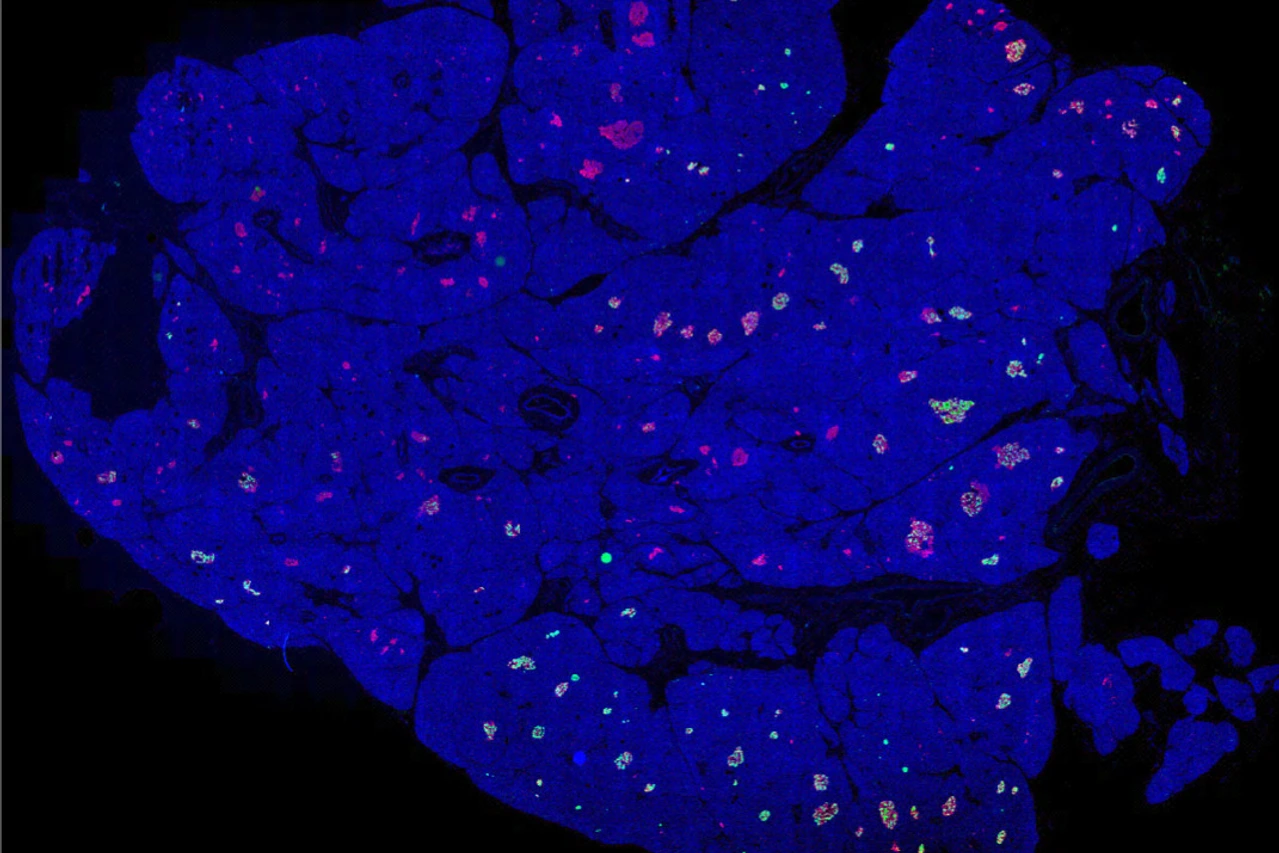 Rodriguez-Calvo_pancreas_whole