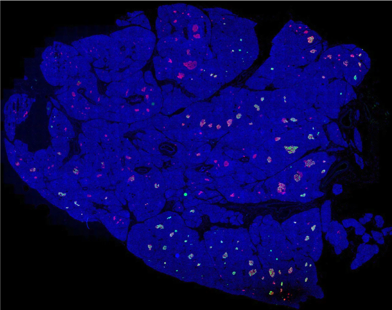Rodriguez-Calvo_pancreas_whole