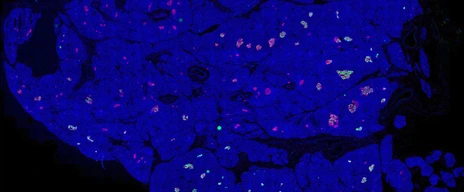 Rodriguez-Calvo_pancreas_whole