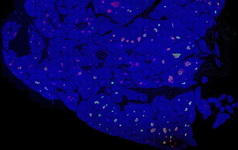 Rodriguez-Calvo_pancreas_whole