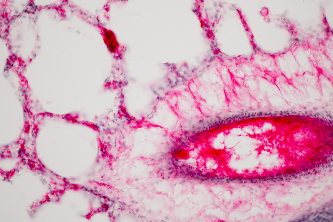 Human lung tissue under microscope view.