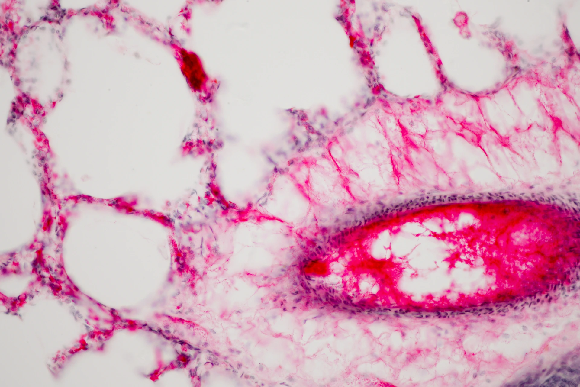 Human lung tissue under microscope view.