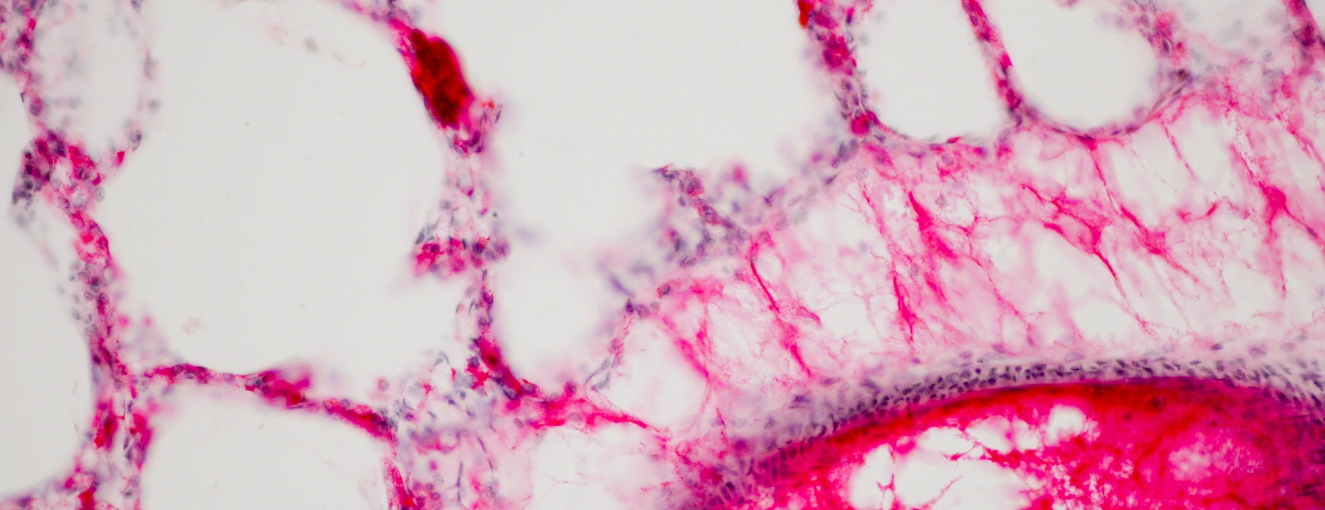 Human lung tissue under microscope view.