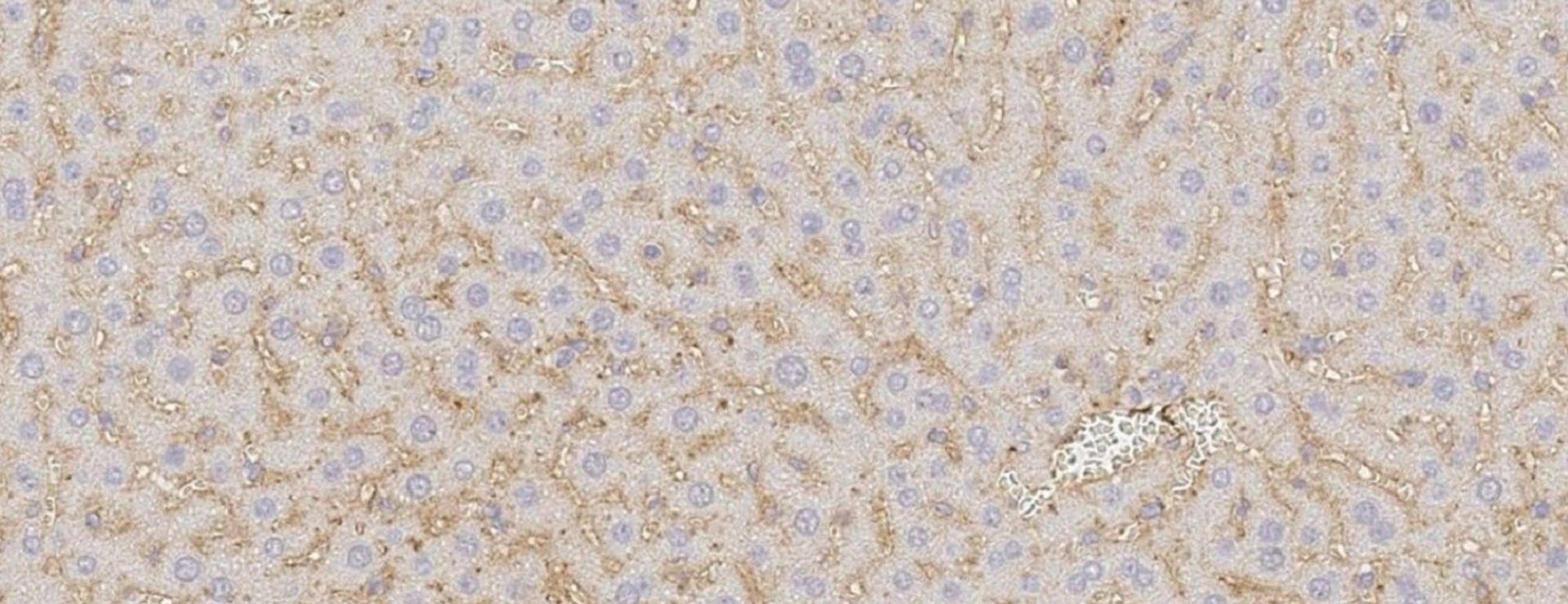 T-cell engager antibodies
