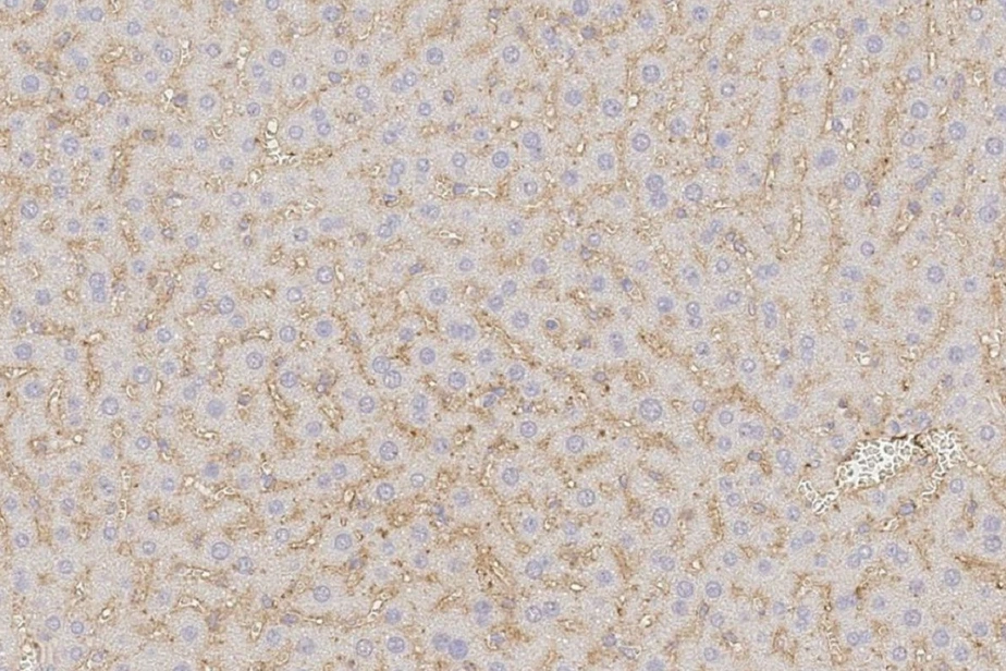 T-cell engager antibodies