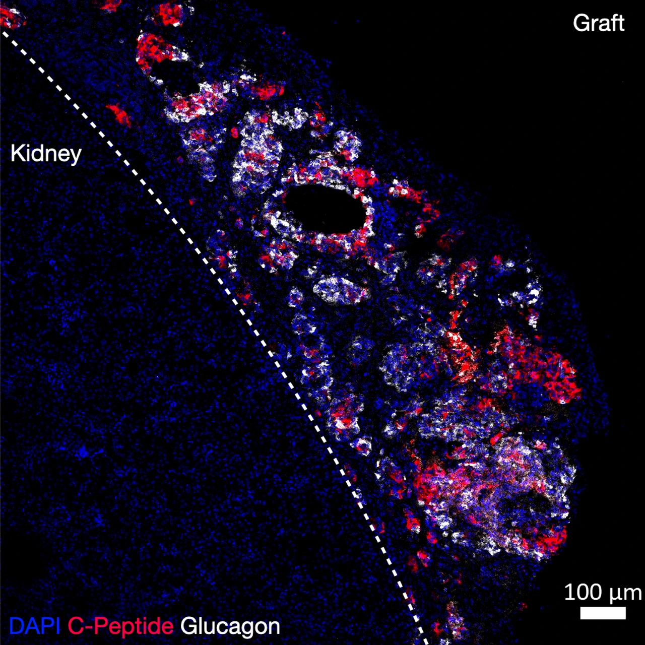 IDR Beta Cell Replacement group_Rogers