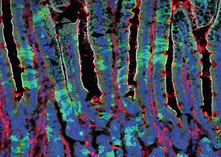 IDR_Cover_nature metab