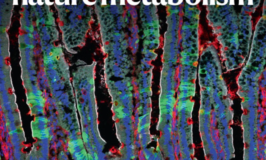 IDR_Cover_nature metab