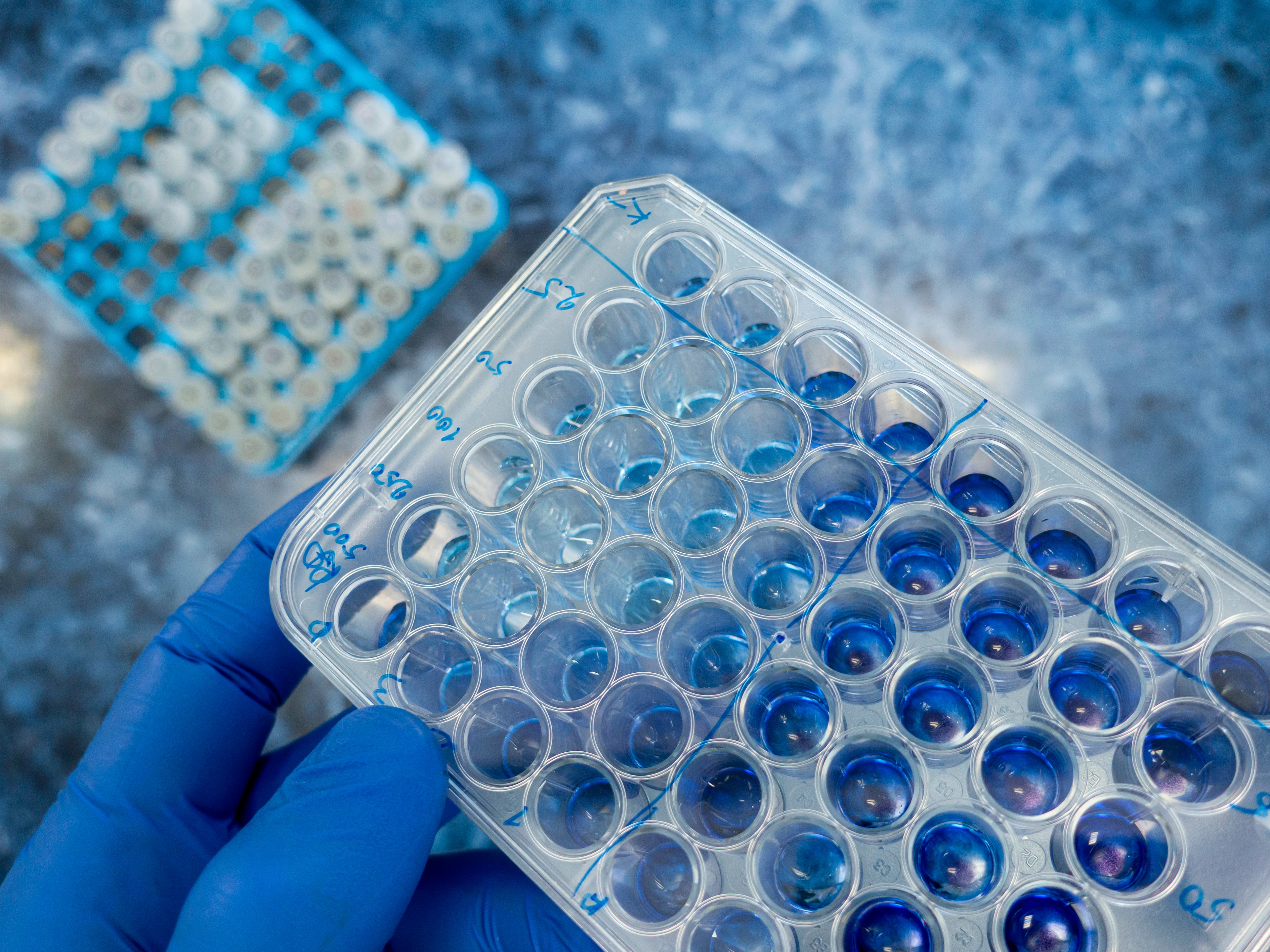 Close-up of a scientist holding a microbiological tablet with antibodies in the laboratory, an experiment with human antibodies.