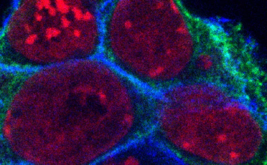 Mouse Embryonic Stem Cells, Mikroskopy Image  by Yung Li Chen
