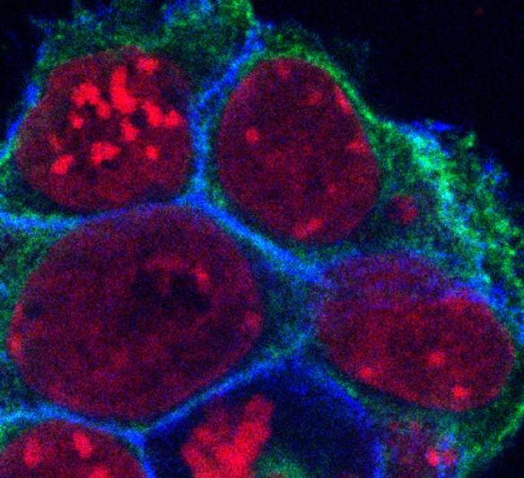 Mouse Embryonic Stem Cells, Mikroskopy Image  by Yung Li Chen