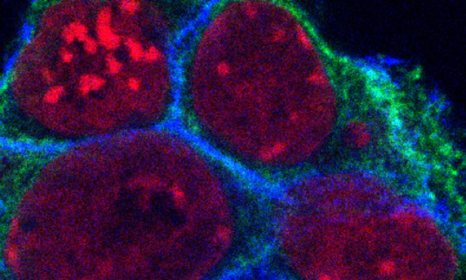 Mouse Embryonic Stem Cells, Mikroskopy Image  by Yung Li Chen