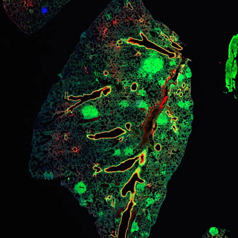 lung cancer Crispr Diefenbacher
