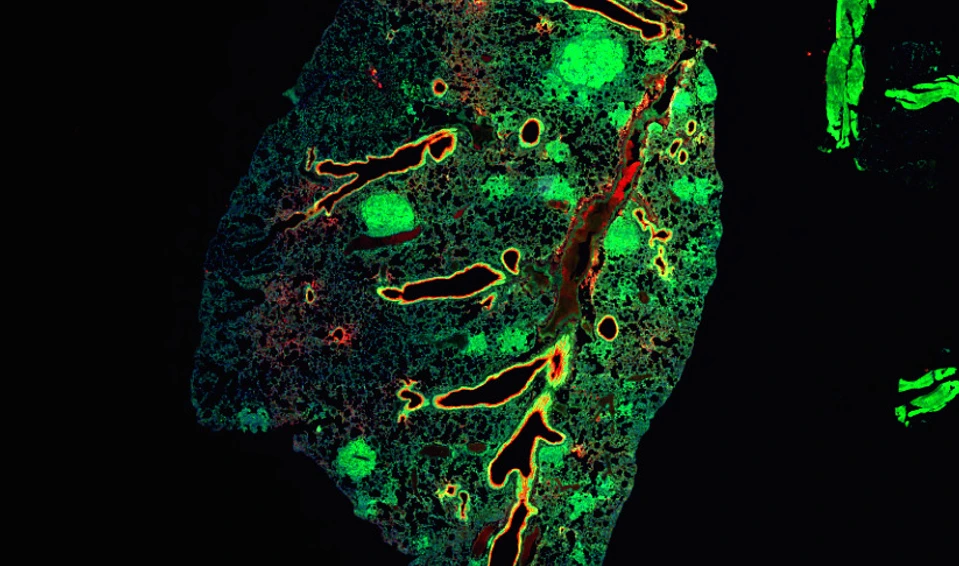 lung cancer Crispr Diefenbacher