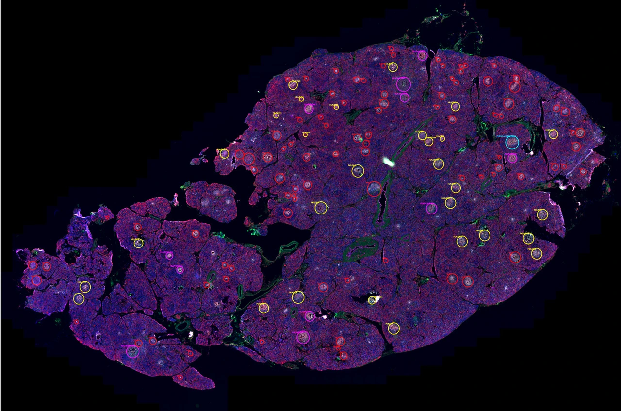 Rodriguez-Calvo_pancreas_markers
