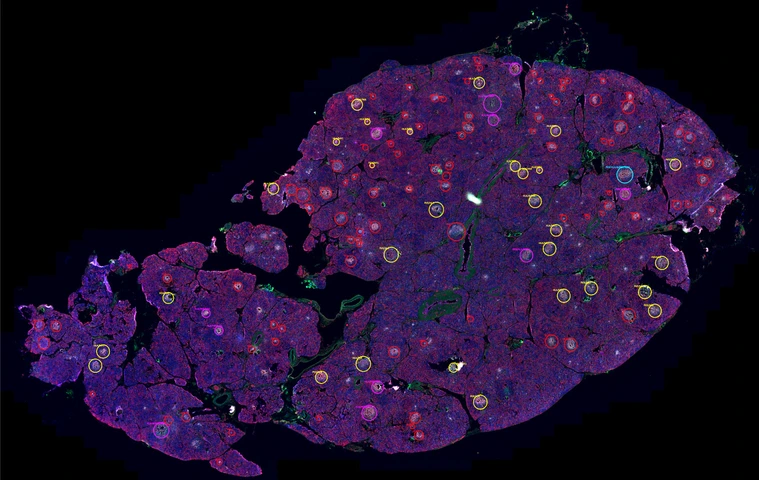 Rodriguez-Calvo_pancreas_markers