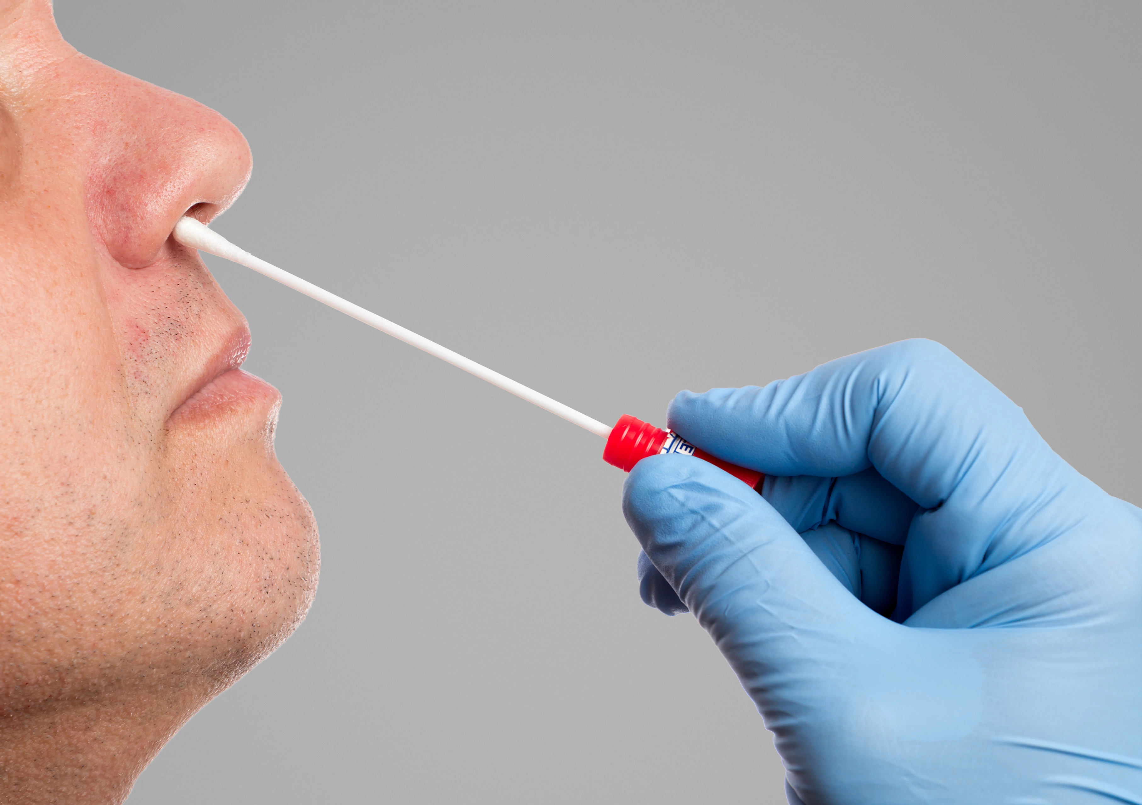 Nasenabstrich zur Erfassung des Mykobioms