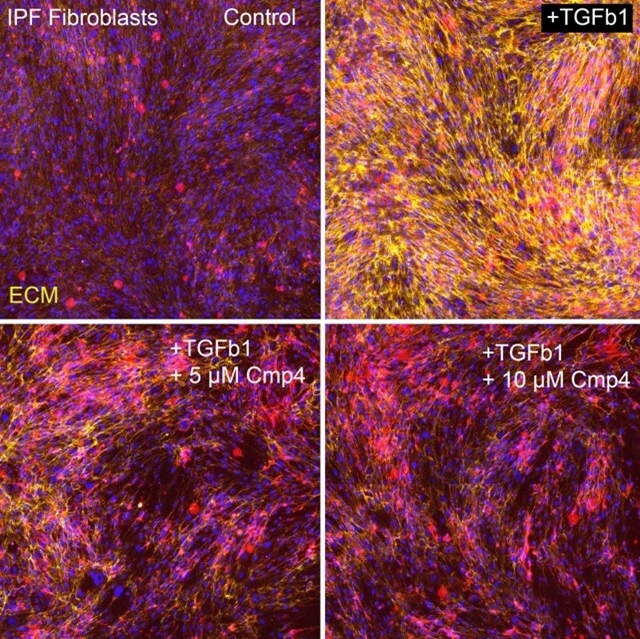 lhi-burgstaller-fibroblasts-tgfbeta