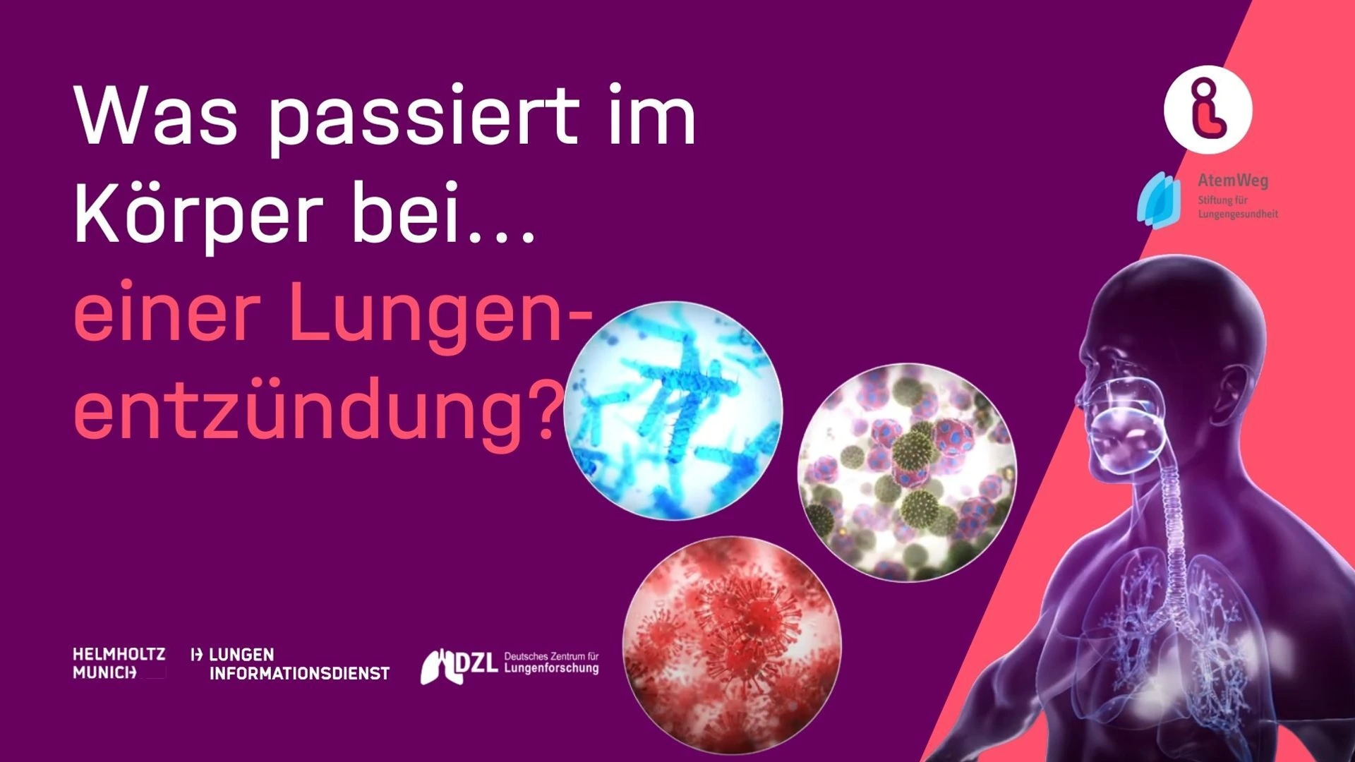 Vorschaubild Video: Was passiert im Körper bei einer Lungenentzündung