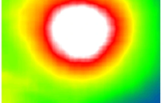 Predicted retinal thickness on funuds image