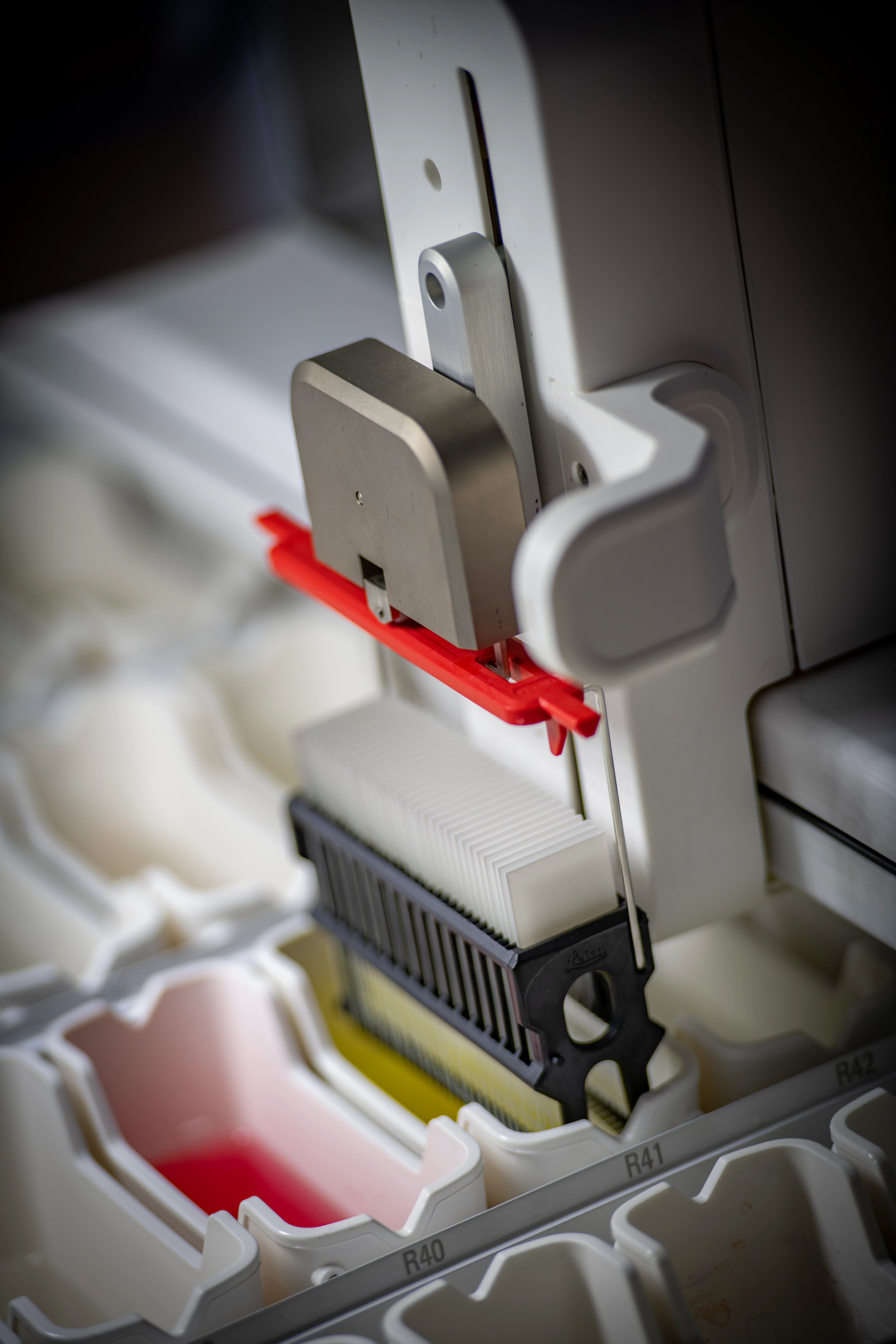 Pathology and Tissue Processing of all fresh