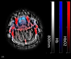 Brain Tomography