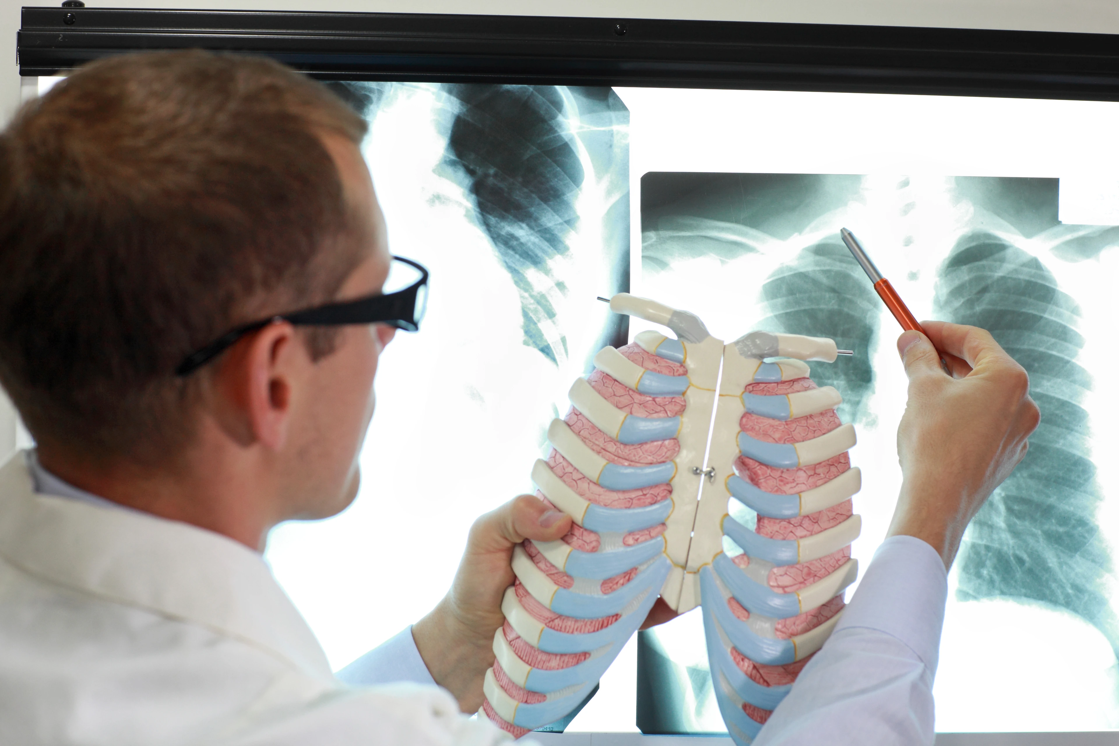 doctor with ribs and lungs model watching image of chest at x-ray film viewer