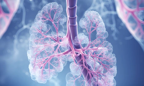 Human lung model with a of disease, generative Ai