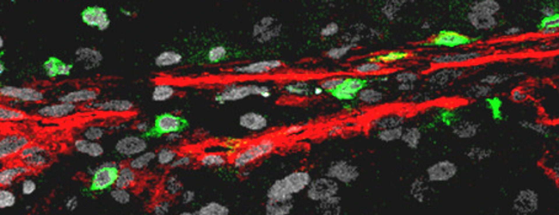 CD31_CD8_RCC T4