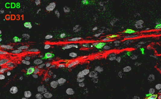 CD31_CD8_RCC T4