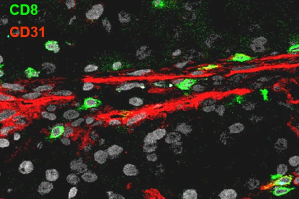 CD31_CD8_RCC T4