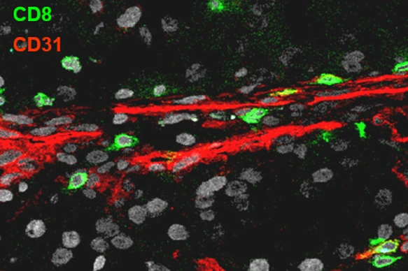 CD31_CD8_RCC T4