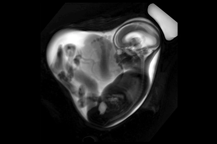 LMU Klinikum Fetale MRT Overview