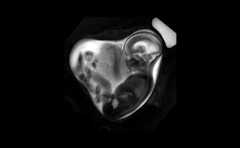 LMU Klinikum Fetale MRT Overview